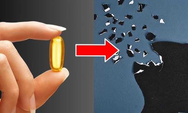 الزائمر سے بچاؤ میں مددگار وٹامنز، تحقیق کیا کہتی ہے؟
