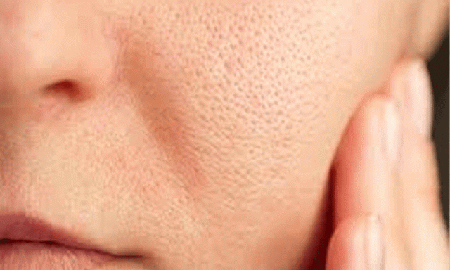 پاکستانی معروف اداکارہ کو اسکن ٹریٹمنٹ کرانا مہنگا پڑگیا