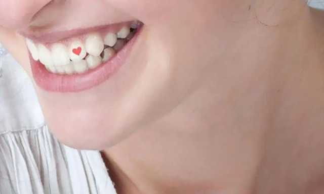 چینی نوجوان دانتوں پر ٹیٹو کیوں بنوا رہے ہیں؟