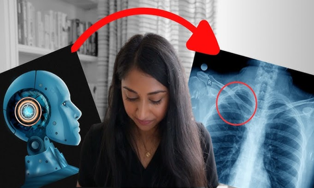 اب اے آئی ہڈی کے فریکچر کی تشخیص بھی کرے گی، یہ ایکس رے مشین سے مخلتف کیسے؟
