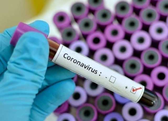 کراچی میں کورونا وائرس سے 4 افراد چل بسے