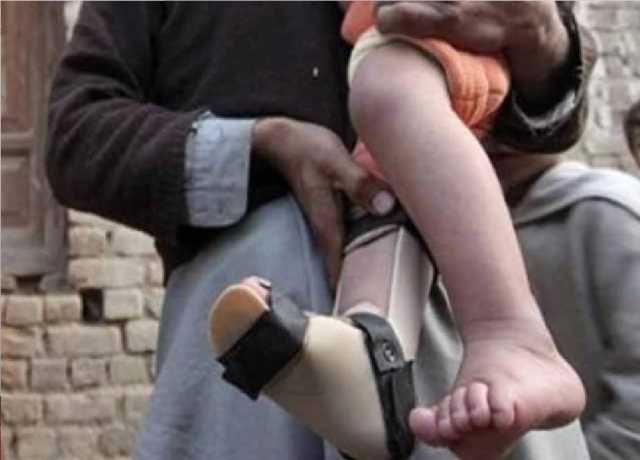 50 اضلاع پولیو سے متاثر، خداکا واسطہ، بچوں کو ویکسین پلائیں، وفاقی وزیر صحت