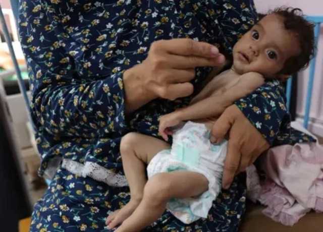 دودھ نہ ملنے پر غزہ میں 40 ہزار بچوں کی اموات کا خدشہ