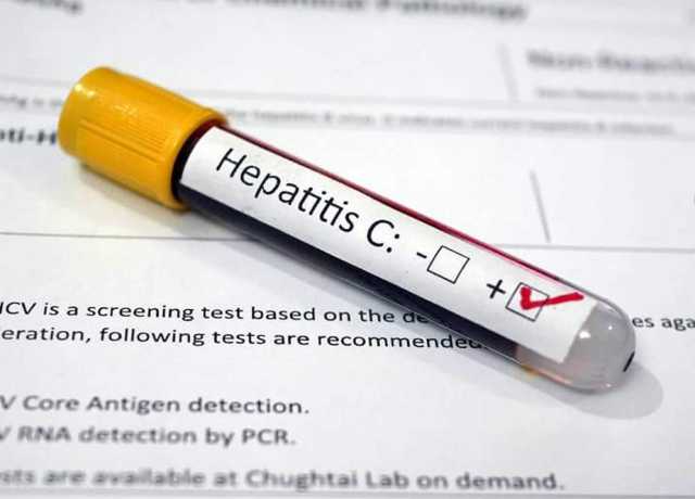 ہیپاٹائٹس فری پروگرام، گلگت بلتستان میں 12 سال سے بڑی عمر کے تمام افراد کی سکریننگ کا فیصلہ