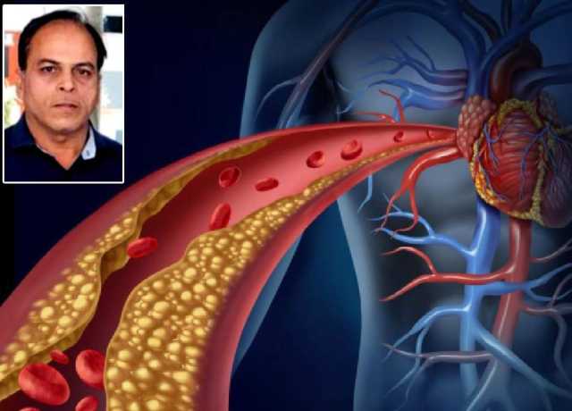 خون میں چربی کی زیادتی (ڈس لپیڈی میا) پر تحقیقی جائزہ