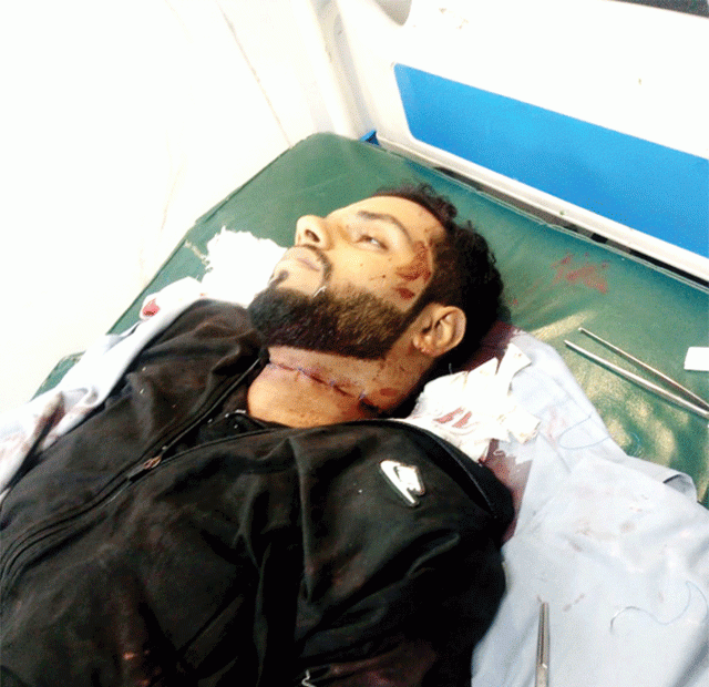 نواں کوٹ : قاتل ڈور نے ایک اور نوجوان کی جان لے لی 