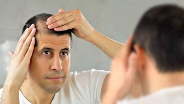 اگر بال جھڑرہے ہیں تو کیاکریں ؟ماہرین نے سستا ترین حل بتادیا