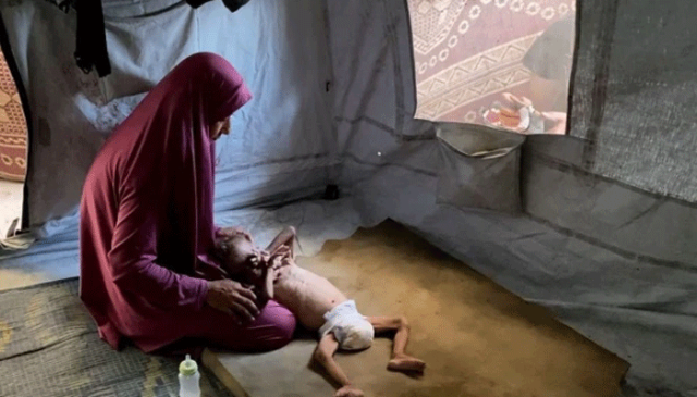 غزہ جنگ میں 21 ہزار فلسطینی بچے معذور ہوگئے، اقوام متحدہ کا لرزہ خیز انکشاف
