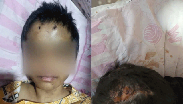 لاہور میں ڈاکٹر میاں بیوی کا 12 سالہ گھریلو ملازمہ پر بدترین تشدد