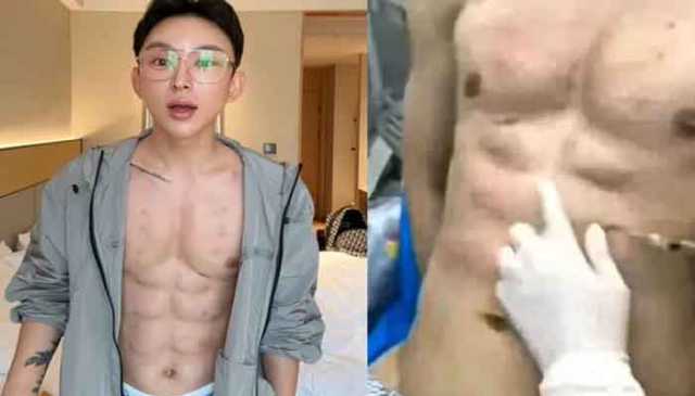 چینی انفلوئنسر نے لاکھوں ڈالر خرچ کرکے جعلی 8 پیک ایبز بنوالیے