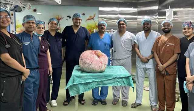 کراچی: خاتون کے پیٹ سے 15 کلو وزنی ٹیومر نکالنے میں کامیابی