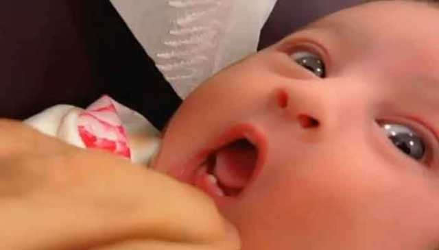 شارجہ: پیدائش کے 6 دن بعد بچی کے دانت نکل آئے
