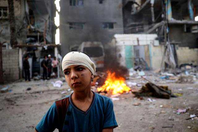 غزہ جنگ میں 21 ہزار فلسطینی بچے معذور ہوگئے، اقوام متحدہ کا لرزہ خیز انکشا