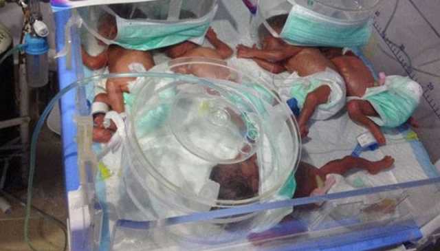 کراچی: نجی اسپتال میں خاتون کے ہاں 5 بچوں کی پیدائش