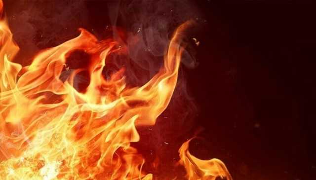 لاہور: ورکشاپ مالک نے 12 سالہ ملازم کو آگ لگادی