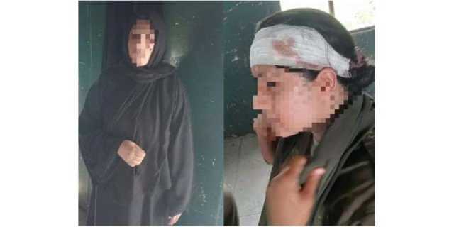 دورانِ چیکنگ کار سوار خاتون کی تلخ کلامی، لیڈی اہلکار کے سر پر لوہے کی بوتل دے ماری
