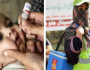 قومی انسداد پولیو مہم شروع، ساڑھے 4 کروڑ بچوں کو قطرے پلانے کا ہدف