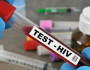 تونسہ:3ماہ کےدوران100سے زائد افراد میں HIVکی تصدیق