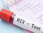 پنجاب کے ضلع تونسہ میں ایچ آئی وی کیسز کی تعداد میں غیر معمولی اضافہ